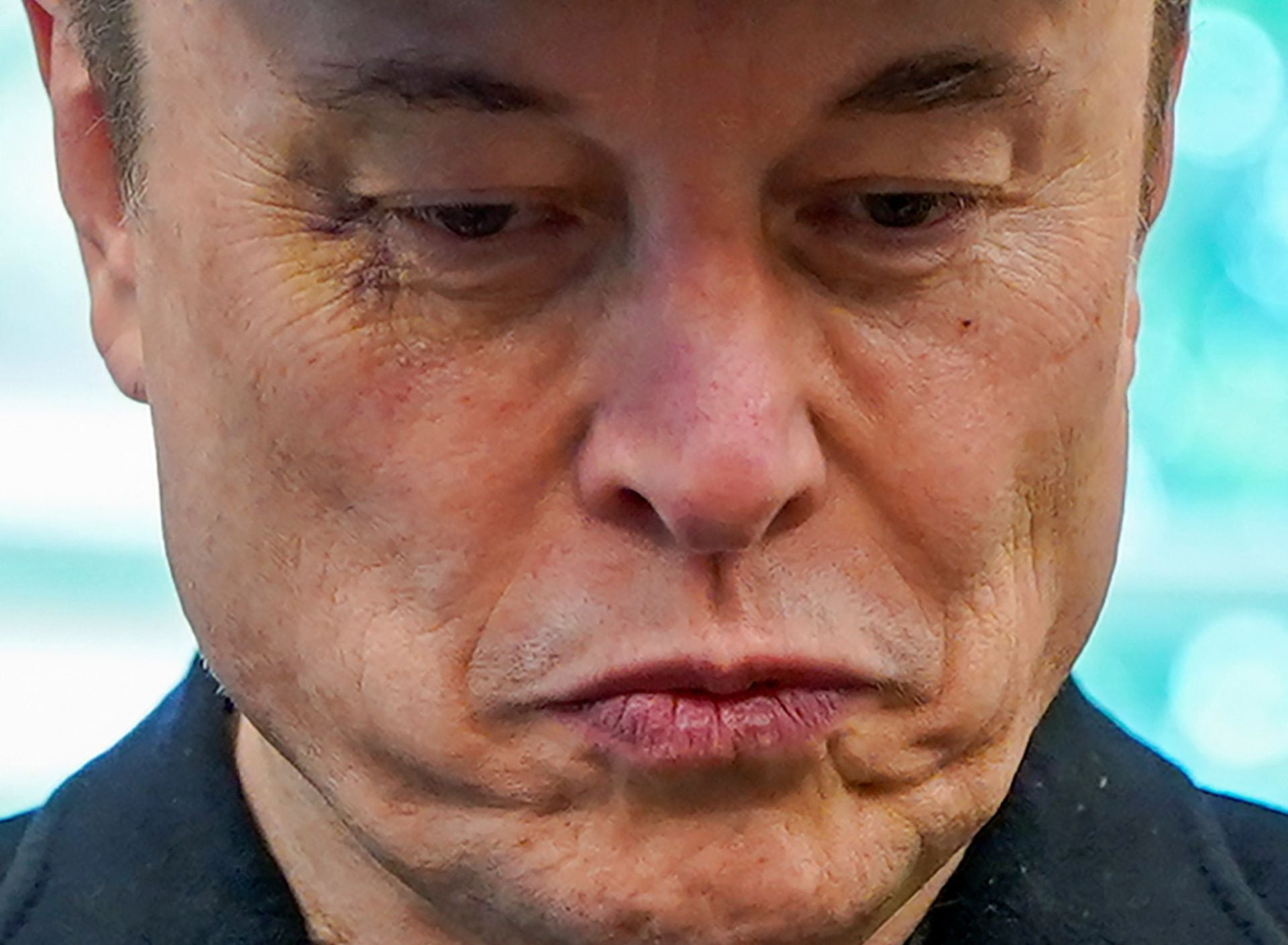 Musk reveals that he has a purple eye because his son hit him