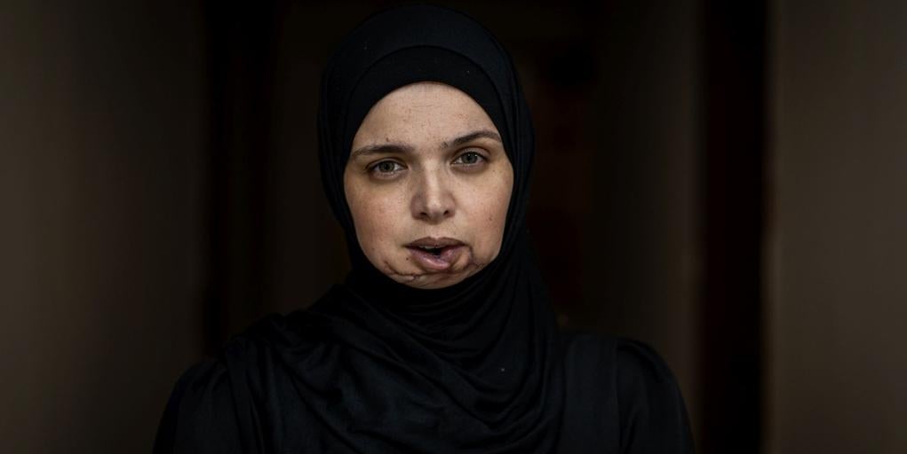 "My goal is to tell the Israeli massacre in Gaza"